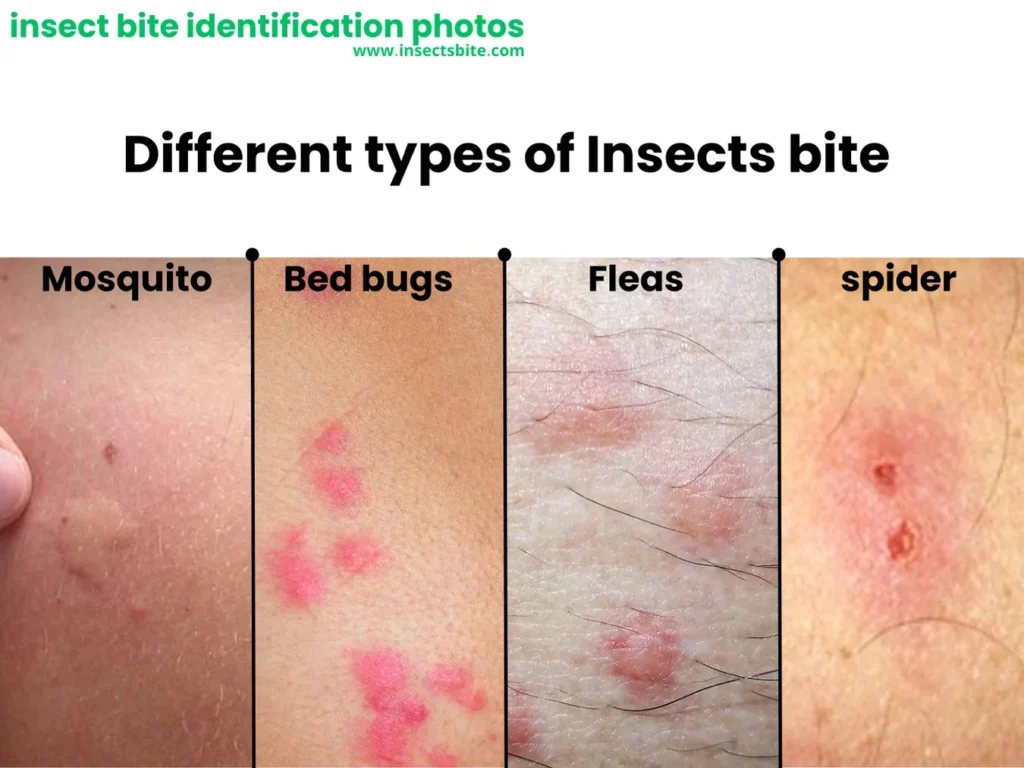 identifying bug bites the ultimate guide with pictures – Signs of Infestation