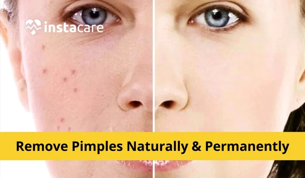 Natural Removal Methods