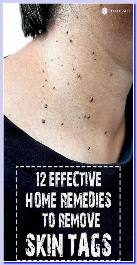 Natural Removal Methods for DIY Homeowners