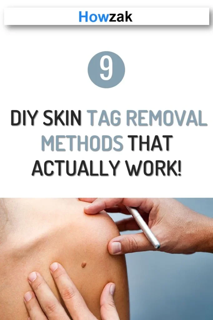 Natural removal methods that actually work