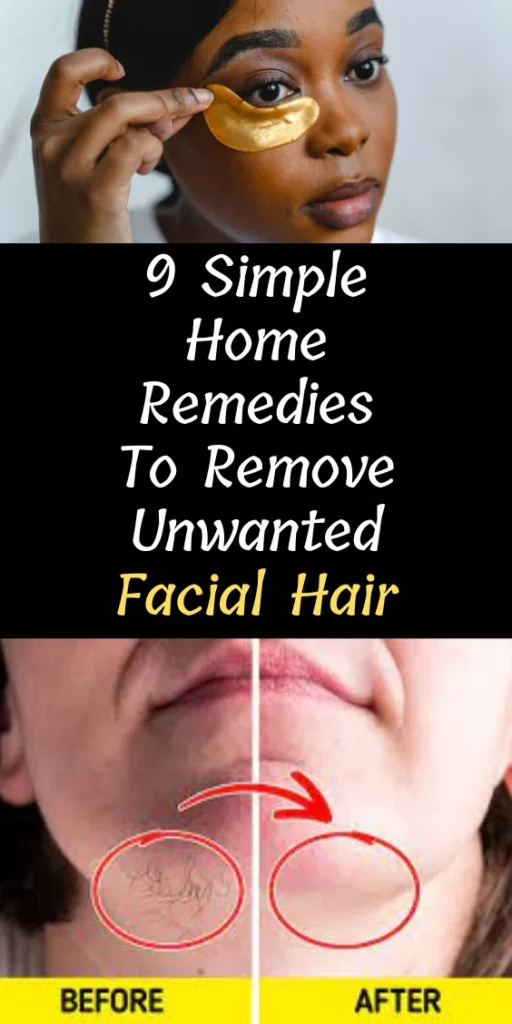 Natural Removal Methods You Can Try