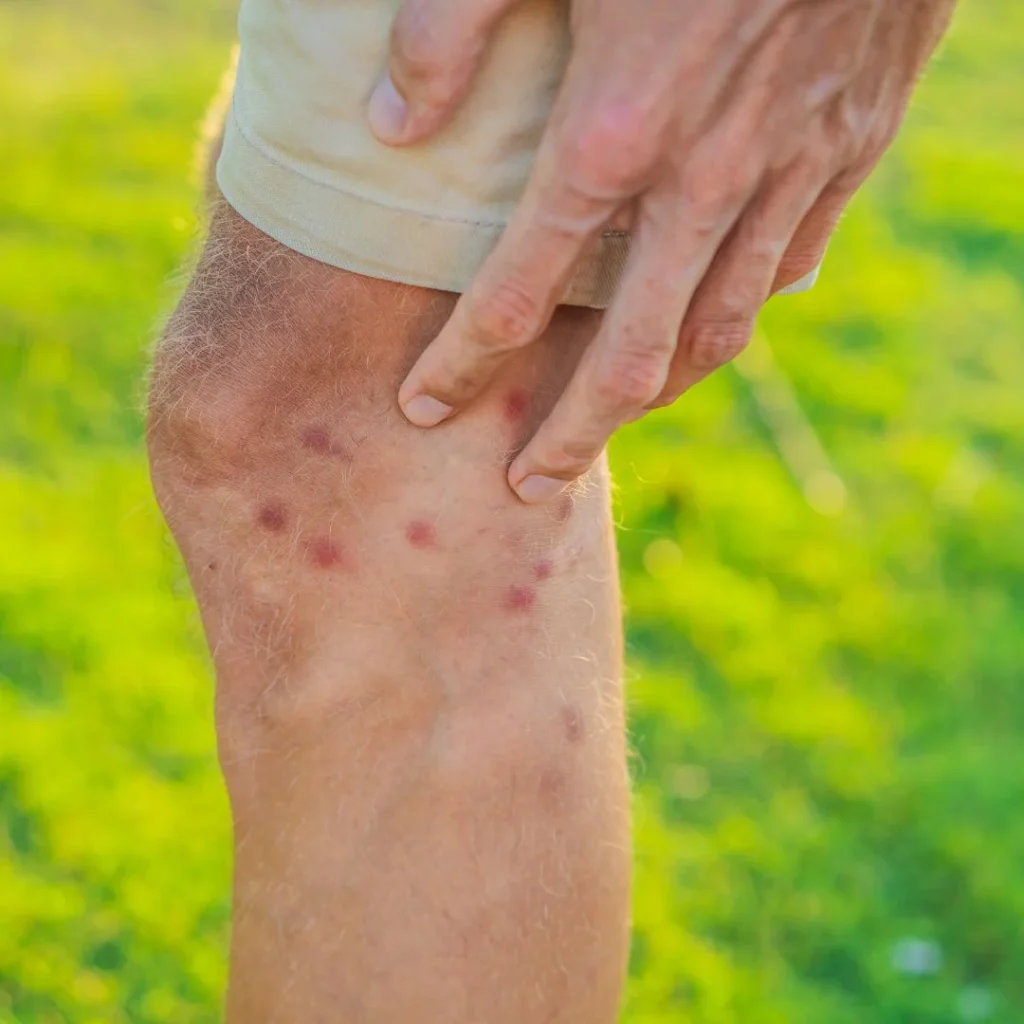 Signs of Mosquito Infestation in Brookhaven GA