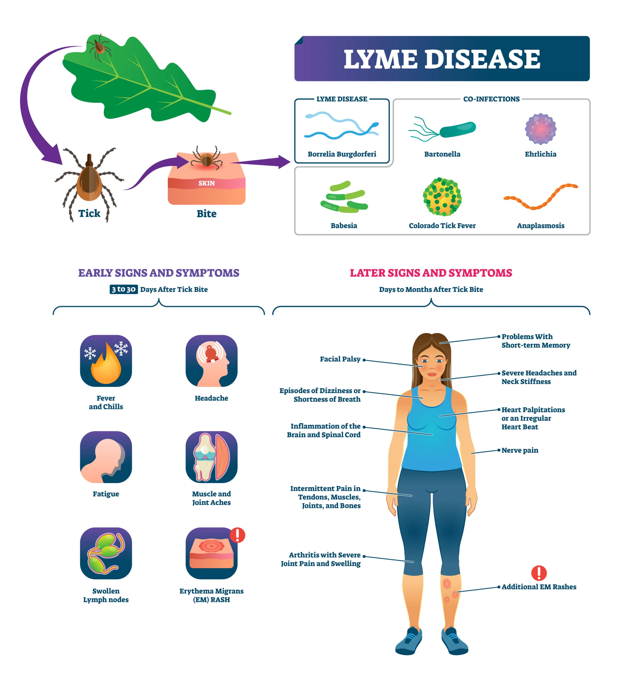 Stages of Lyme Disease – An Overview