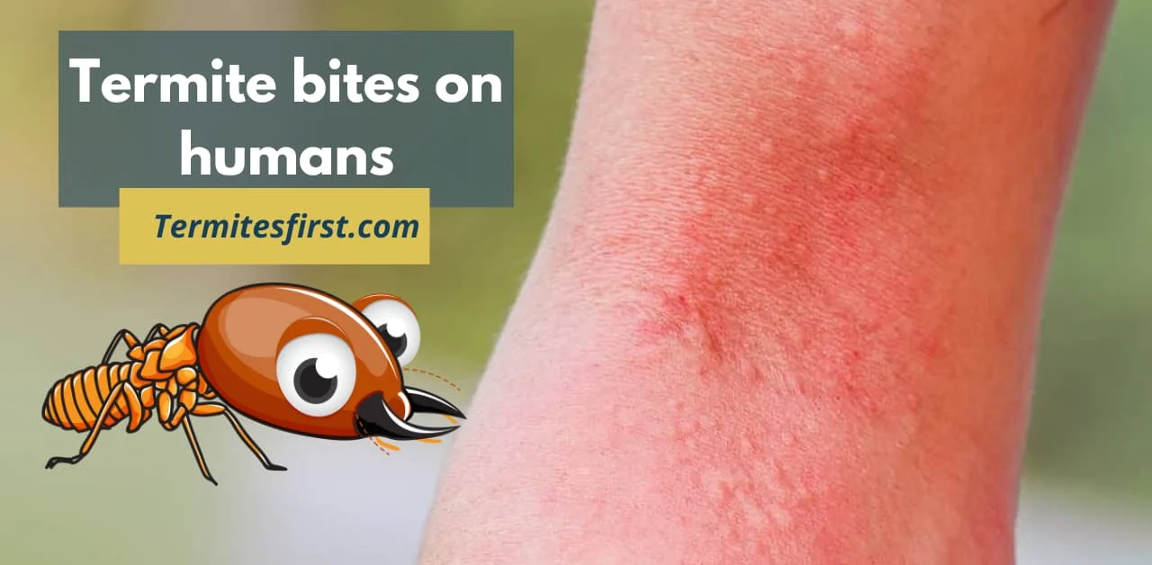 What Does Termite Bites Look Like
