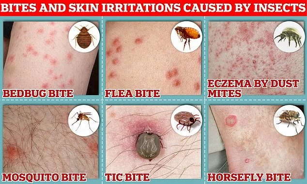 When bed bugs bite you: Immediate Reactions and What to Expect