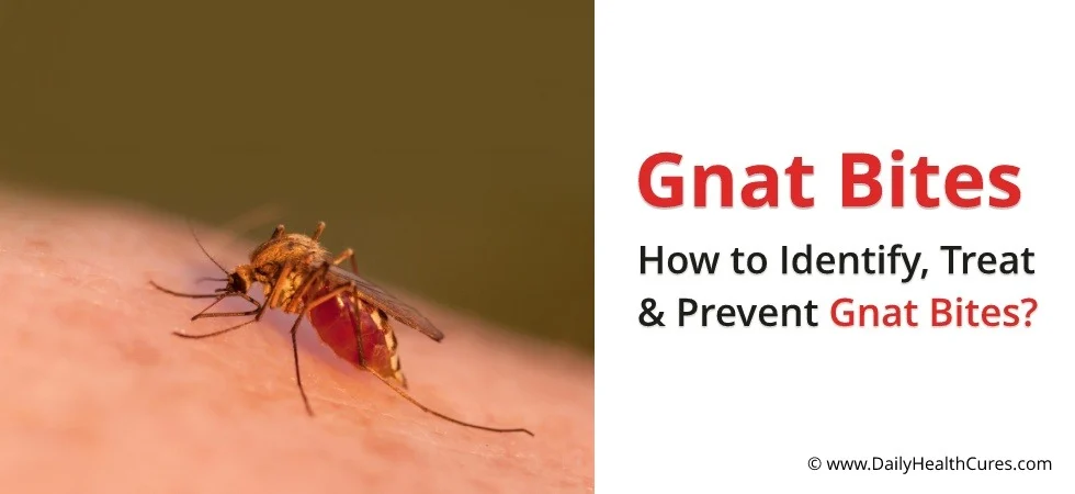 Why gnat bites on humans occur in and around homes