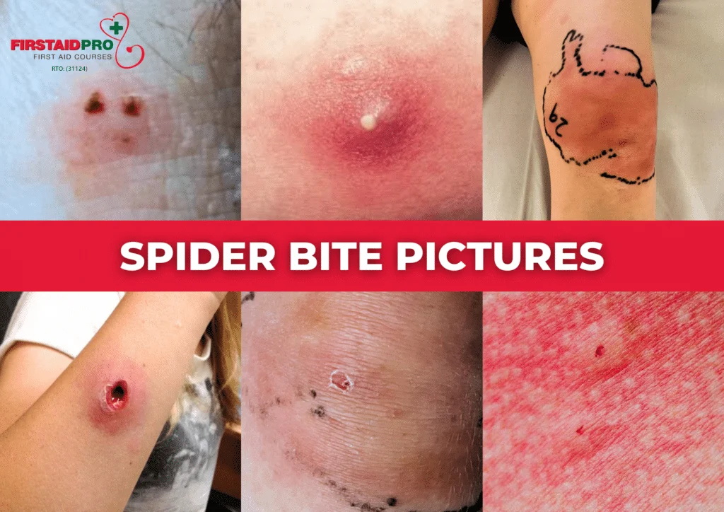 Why Spider Bites on Humans Occur Inside the Home