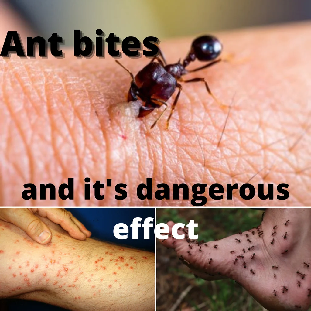 Why ant bites on humans happen in homes