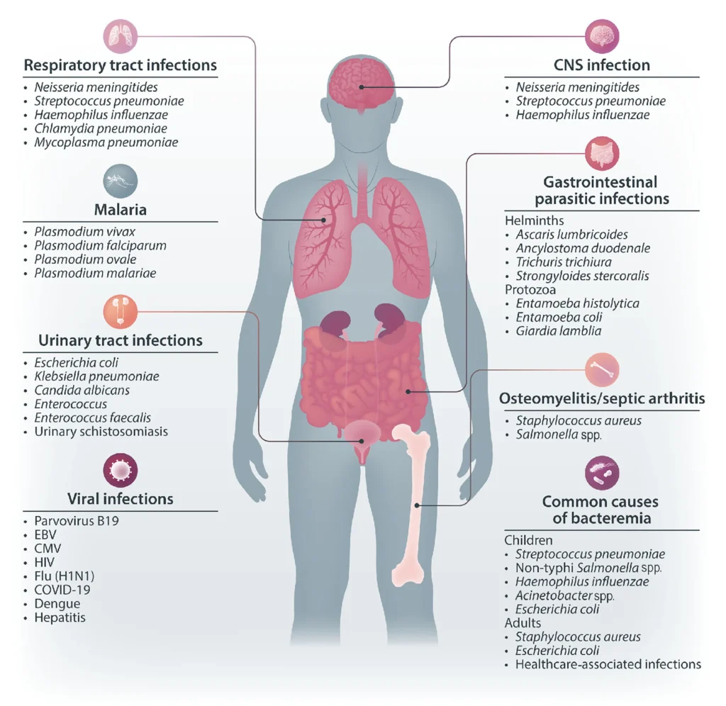 Why This Disease Appears in Certain Areas